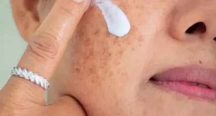 Dermatoloji uzmanından güneş ışınları uyarısı