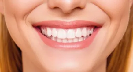Diş estetiği nedir? Diş estetiği kalıcı mı?