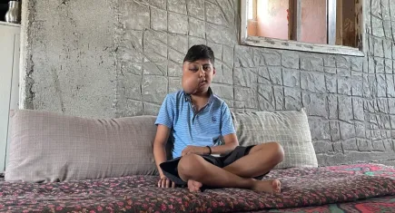 Milyon bir görülüyordu, 14 yaşındaki Enes’te çıktı: İki farklı yüzü var gibi görünen Enes’in tek isteği iyileşip gülmek