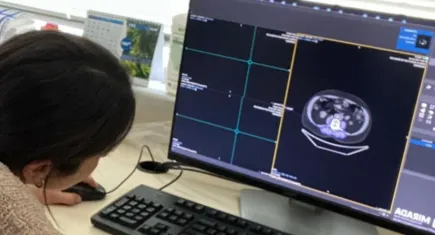 Makine öğrenmesi ile akciğer kanseri tanısında yeni dönem