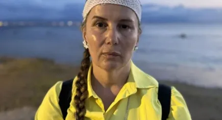 Denizde yüzerken jet ski çarpan kadın neye uğradığını şaşırdı