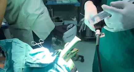 Ameliyatta hastanın kafatasına delik açtı