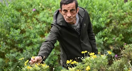 Türkiye’nin ilk yüz nakliyle hayata yeniden başlayan Uğur Acar, organ bağışına vurgu yapıyor