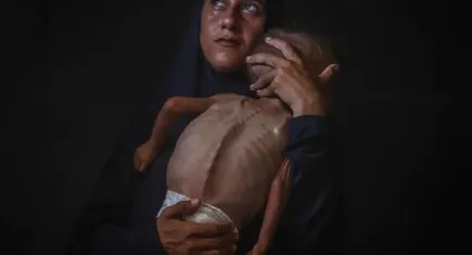 İnsani yardım engellendi, Gazze’de bebekler açlıktan ölüyor