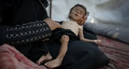 Gazze’de açlık ve saldırılar kâbusu: 24 saatte 11 kişi daha hayatını kaybetti