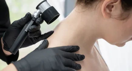 Cildiniz sinyal veriyor olabilir: Yaz sonrası cilt check-up’ını ihmal etmeyin