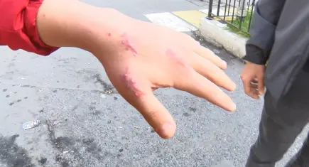 Kedi ısırığı sonrası hastaneye gitti, tendon kopması için şikayetçi oldu