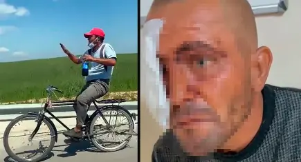 Adana’da zihinsel engelli sosyal medya fenomeni darbedildi